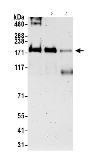 Western blot - Anti-KMT2A / MLL antibody (AB272023)