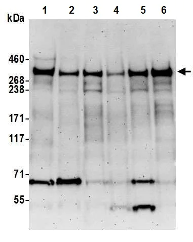 Western blot - Anti-KMT2A / MLL antibody [BL-175-7E8] (AB243867)