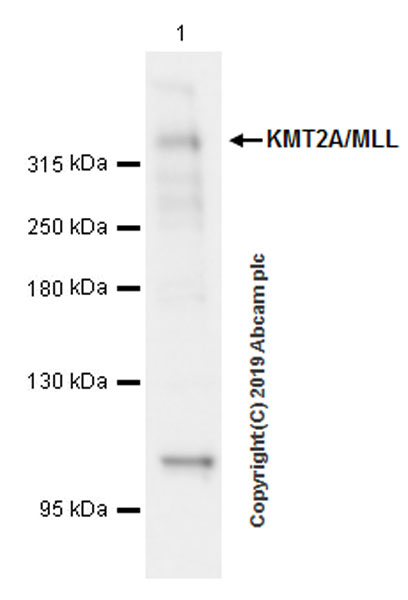 Western blot - Anti-KMT2A / MLL antibody [EPR22647-8] (AB234435)