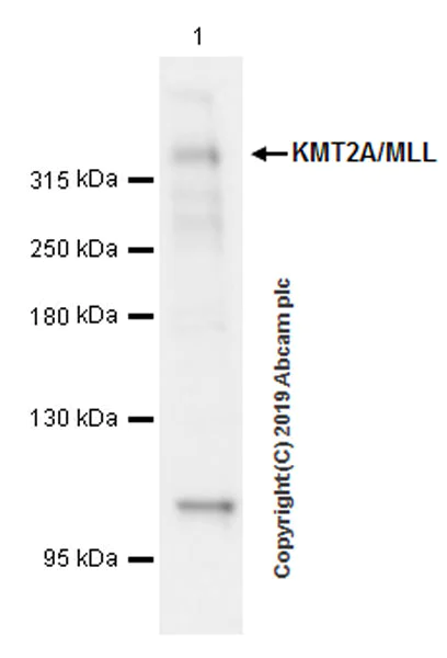 Western blot - Anti-KMT2A / MLL antibody [EPR22647-8] (AB234435)
