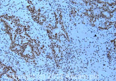Immunohistochemistry (Formalin/PFA-fixed paraffin-embedded sections) - Anti-KMT2A / MLL antibody [mmN4.4] (AB32400), expandable thumbnail