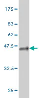 Western blot - Anti-KMT2B / MLL4 antibody [4C10] (AB56770)