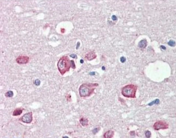 Immunohistochemistry (Formalin/PFA-fixed paraffin-embedded sections) - Anti-KMT2B / MLL4 antibody (AB104444)