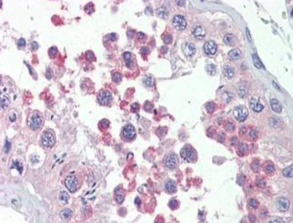 Immunohistochemistry (Formalin/PFA-fixed paraffin-embedded sections) - Anti-KMT2B / MLL4 antibody (AB104444)