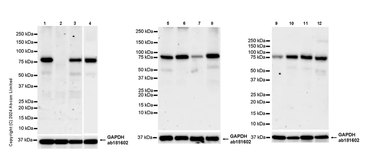 Western blot - Anti-KMT2B / MLL4 antibody [EPR27970-7] - C-terminal (AB319035)