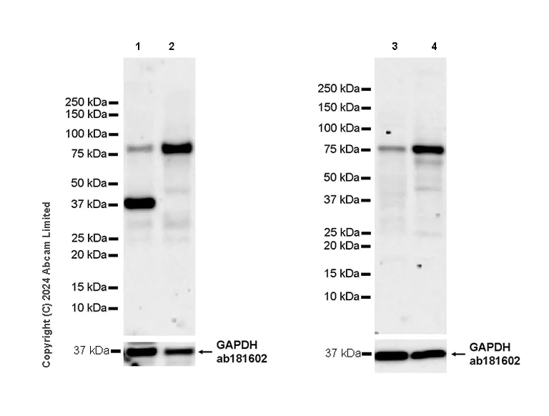 Western blot - Anti-KMT2B / MLL4 antibody [EPR27970-7] - C-terminal (AB319035)