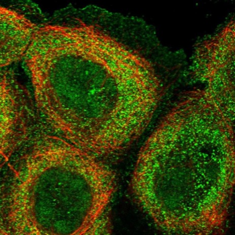 Immunocytochemistry/ Immunofluorescence - Anti-KMT2D / MLL2 antibody (AB224156), expandable thumbnail