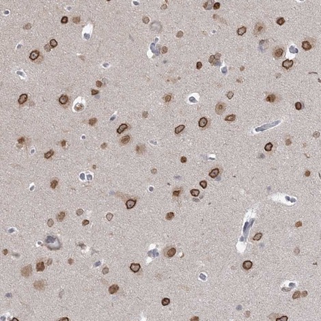 Immunohistochemistry (Formalin/PFA-fixed paraffin-embedded sections) - Anti-KMT2D / MLL2 antibody (AB224156), expandable thumbnail