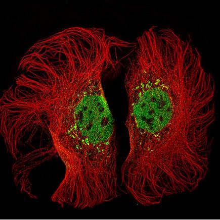 Immunocytochemistry/ Immunofluorescence - Anti-KMT2D / MLL2 antibody [CL5346] (AB243044)