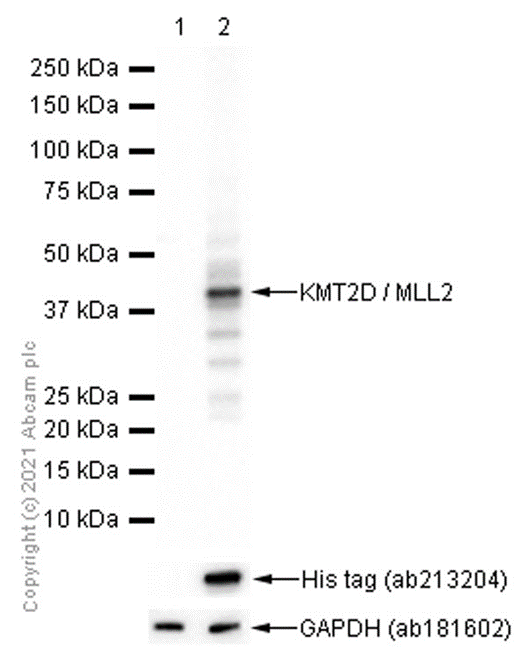 Western blot - Anti-KMT2D / MLL2 antibody [EPR20604-73] (AB213721), expandable thumbnail