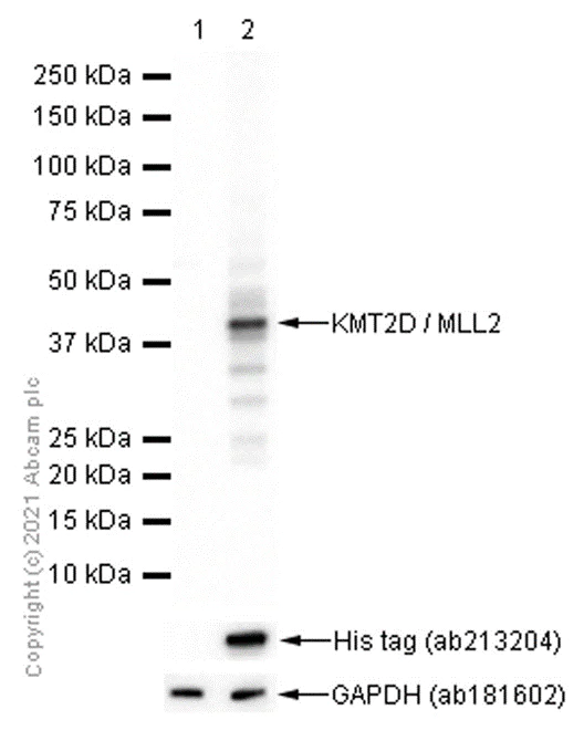 Western blot - Anti-KMT2D / MLL2 antibody [EPR20604-73] (AB213721)
