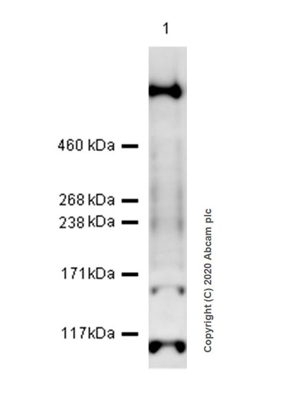 Western blot - Anti-KMT2D / MLL2 antibody [EPR20604-73] (AB213721), expandable thumbnail