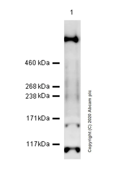 Western blot - Anti-KMT2D / MLL2 antibody [EPR20604-73] - BSA and Azide free (AB274431)