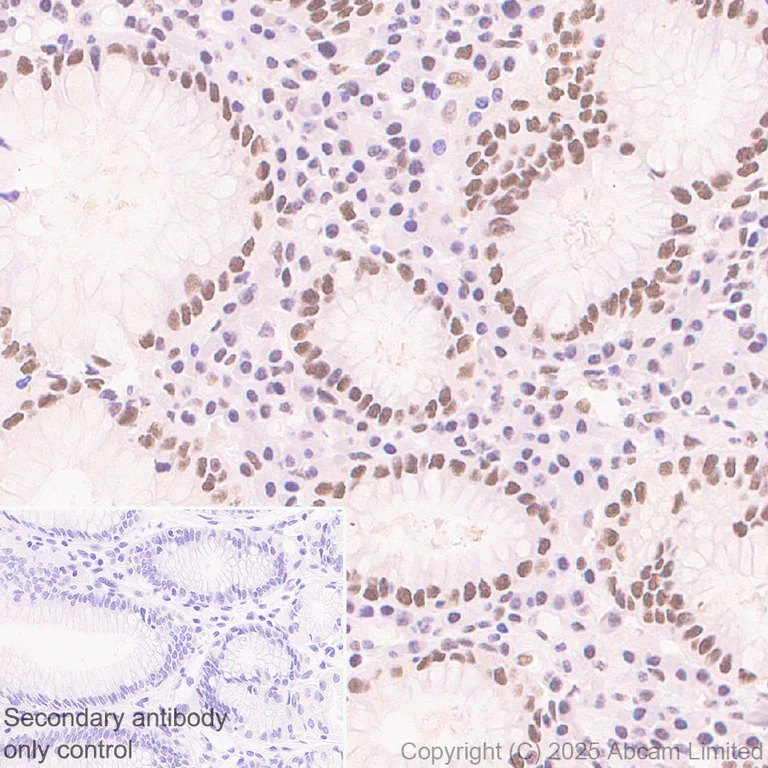 Immunohistochemistry (Formalin/PFA-fixed paraffin-embedded sections) - Anti-KMT2D / MLL2 antibody [EPR29598-577] (AB324486)