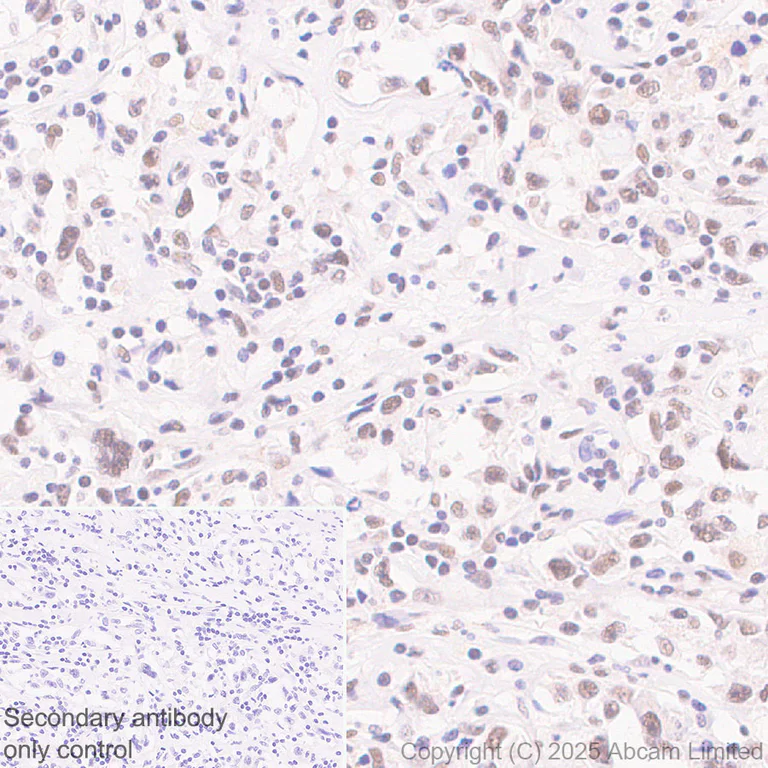 Immunohistochemistry (Formalin/PFA-fixed paraffin-embedded sections) - Anti-KMT2D / MLL2 antibody [EPR29598-577] (AB324486)