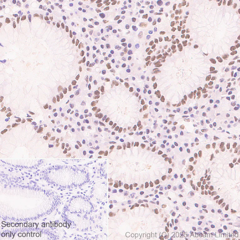 Immunohistochemistry (Formalin/PFA-fixed paraffin-embedded sections) - Anti-KMT2D / MLL2 antibody [EPR29598-577] - BSA and Azide free (AB325958)