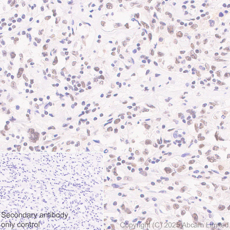 Immunohistochemistry (Formalin/PFA-fixed paraffin-embedded sections) - Anti-KMT2D / MLL2 antibody [EPR29598-577] - BSA and Azide free (AB325958)