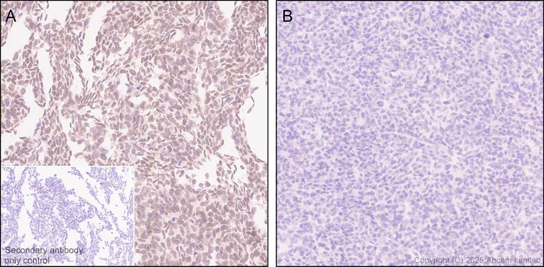 Immunohistochemistry (Formalin/PFA-fixed paraffin-embedded sections) - Anti-KMT2D / MLL2 antibody [EPR29598-577] - BSA and Azide free (AB325958)