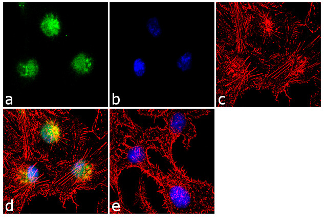 Immunocytochemistry/ Immunofluorescence - Anti-KMT2D / MLL2 antibody [RP23040123] (AB313444), expandable thumbnail