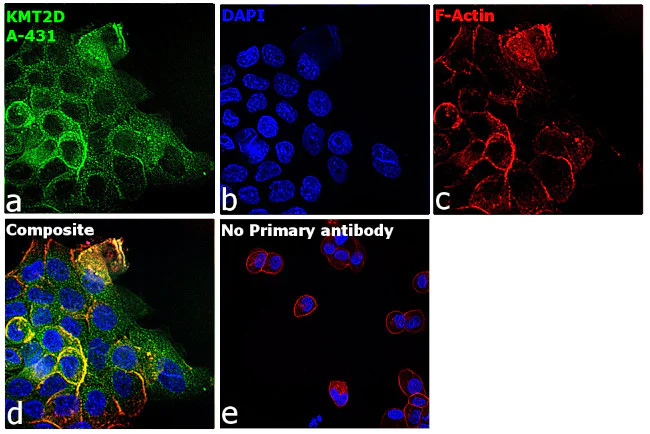 Immunocytochemistry/ Immunofluorescence - Anti-KMT2D / MLL2 antibody [RP23040123] (AB313444)