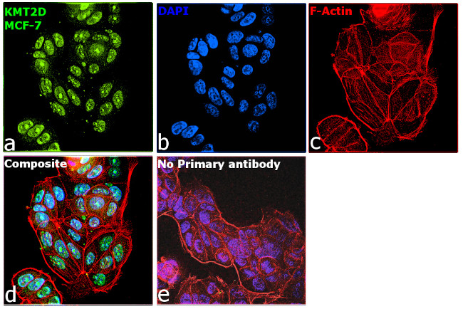 Immunocytochemistry/ Immunofluorescence - Anti-KMT2D / MLL2 antibody [RP23040123] (AB313444), expandable thumbnail