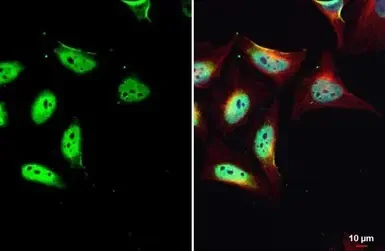 Immunocytochemistry/ Immunofluorescence - Anti-KMT3A / HYPB / HIF-1 antibody (AB184190)