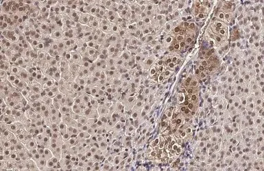 Immunohistochemistry (Formalin/PFA-fixed paraffin-embedded sections) - Anti-KMT3A / HYPB / HIF-1 antibody (AB184190)
