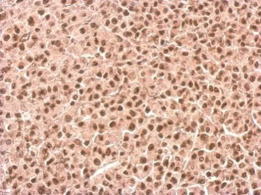 Immunohistochemistry (Formalin/PFA-fixed paraffin-embedded sections) - Anti-KMT3A / HYPB / HIF-1 antibody (AB184190)