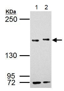 Western blot - Anti-KMT3A / HYPB / HIF-1 antibody (AB184190), expandable thumbnail