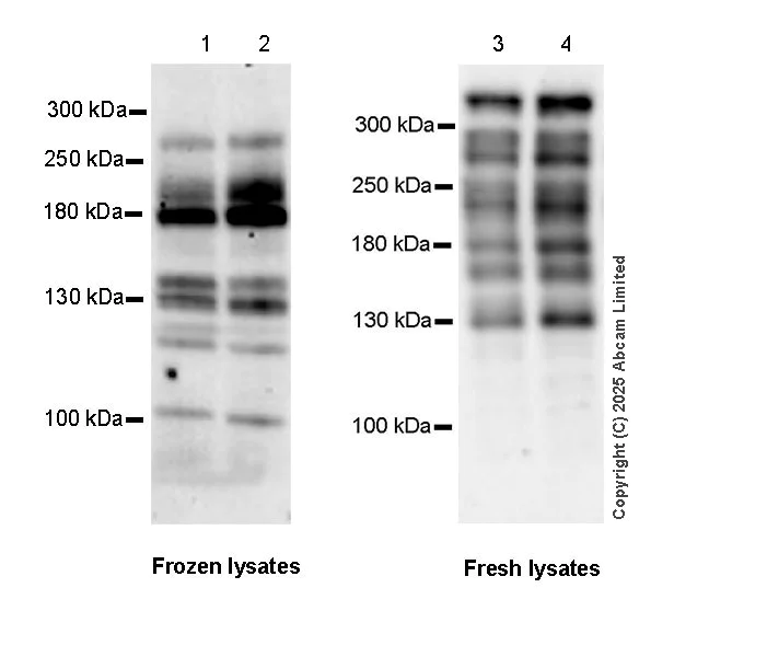 Western blot - Anti-KMT3A / HYPB / HIF-1 antibody [EPR28172-44] (AB324102)