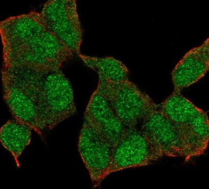 Immunocytochemistry/ Immunofluorescence - Anti-KMT3B / NSD1 antibody (AB222145)