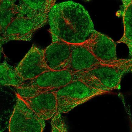 Immunocytochemistry/ Immunofluorescence - Anti-KMT3B / NSD1 antibody (AB226247)