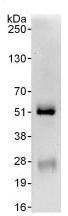 Immunoprecipitation - Anti-KMT3C / SMYD2 antibody (AB108217)
