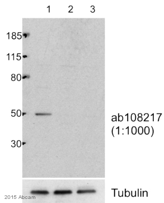 Western blot - Anti-KMT3C / SMYD2 antibody (AB108217)