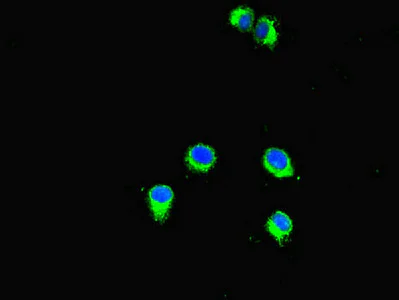 Immunocytochemistry/ Immunofluorescence - Anti-KMT3C / SMYD2 antibody (AB234862)