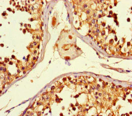Immunohistochemistry (Formalin/PFA-fixed paraffin-embedded sections) - Anti-KMT3C / SMYD2 antibody (AB234862)