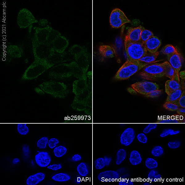 Immunocytochemistry/ Immunofluorescence - Anti-KMT3C / SMYD2 antibody [EPR24071-25] (AB259973)