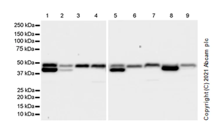 Western blot - Anti-KMT3C / SMYD2 antibody [EPR24071-25] (AB259973)