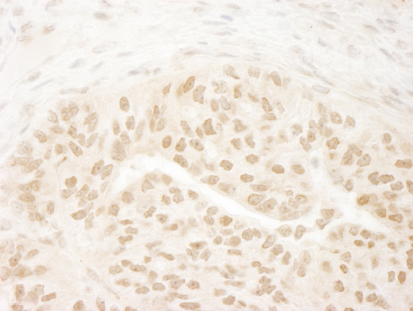 Immunohistochemistry (Formalin/PFA-fixed paraffin-embedded sections) - Anti-KMT4 / Dot1L antibody (AB72454), expandable thumbnail