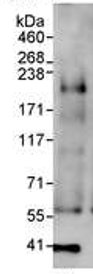 Immunoprecipitation - Anti-KMT4 / Dot1L antibody (AB72454), expandable thumbnail