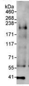 Immunoprecipitation - Anti-KMT4 / Dot1L antibody (AB72454)