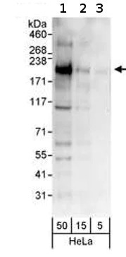 Western blot - Anti-KMT4 / Dot1L antibody (AB72454)