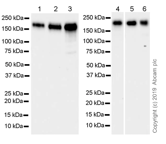Western blot - Anti-KMT4 / Dot1L antibody [EPR22936-138] (AB239358)