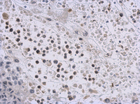 Immunohistochemistry (Formalin/PFA-fixed paraffin-embedded sections) - Anti-KMT5A / SETD8 / Pr-SET7 antibody (AB111691), expandable thumbnail