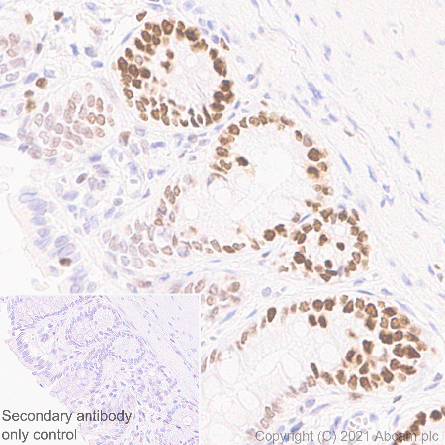 Immunohistochemistry (Formalin/PFA-fixed paraffin-embedded sections) - Anti-KMT6/EZH2 antibody [11/EZH2] - BSA and Azide free (AB283294), expandable thumbnail