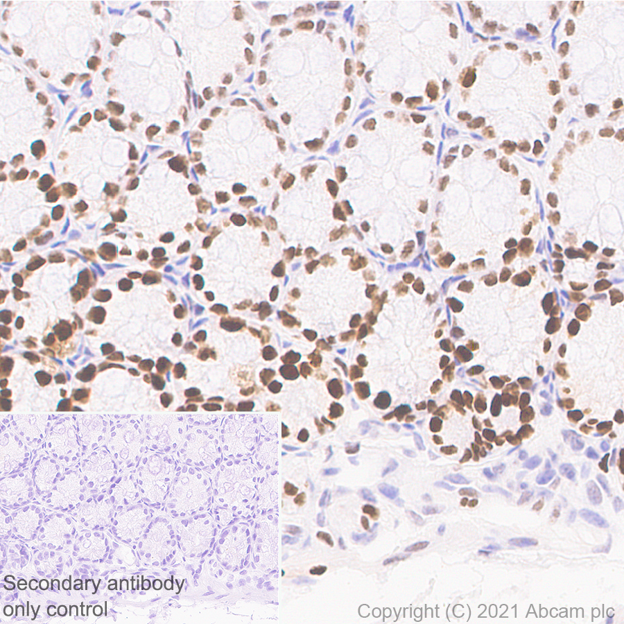 Immunohistochemistry (Formalin/PFA-fixed paraffin-embedded sections) - Anti-KMT6/EZH2 antibody [11/EZH2] - BSA and Azide free (AB283294), expandable thumbnail