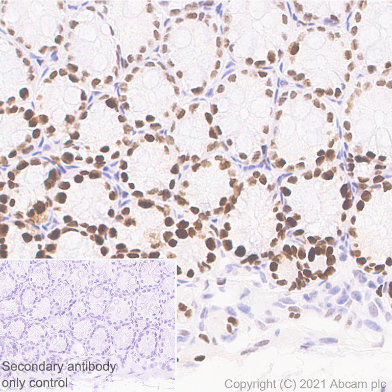 Immunohistochemistry (Formalin/PFA-fixed paraffin-embedded sections) - Anti-KMT6/EZH2 antibody [11/EZH2] - BSA and Azide free (AB283294)