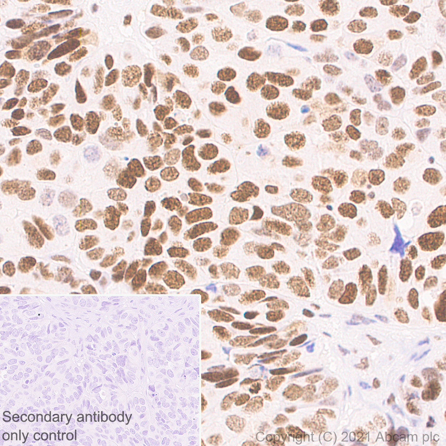 Immunohistochemistry (Formalin/PFA-fixed paraffin-embedded sections) - Anti-KMT6/EZH2 antibody [11/EZH2] - BSA and Azide free (AB283294), expandable thumbnail