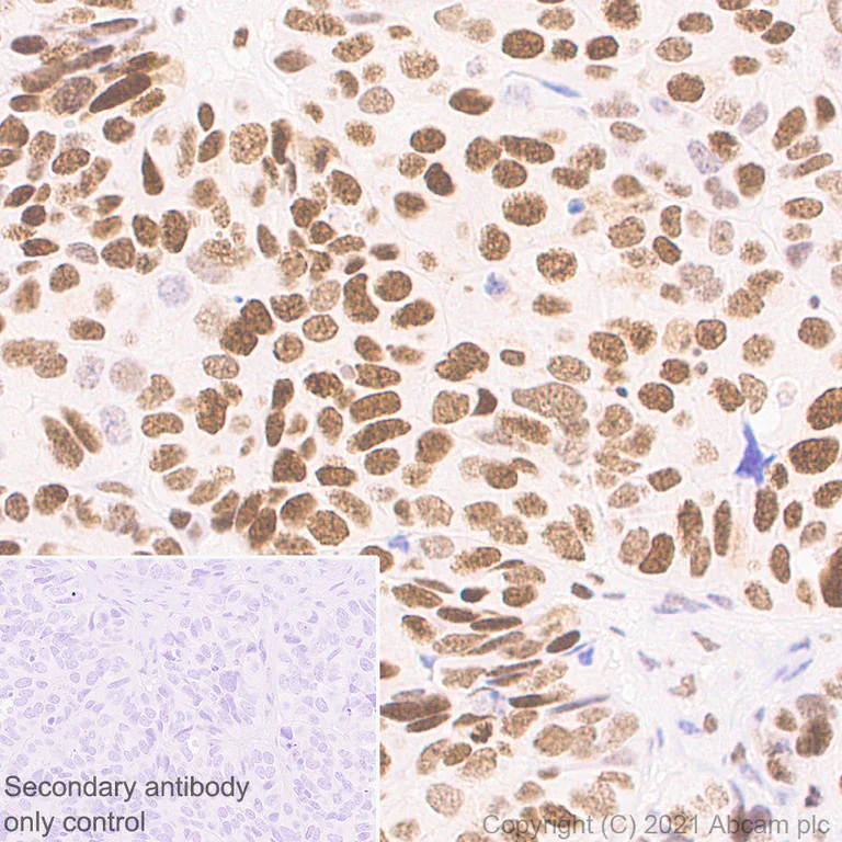 Immunohistochemistry (Formalin/PFA-fixed paraffin-embedded sections) - Anti-KMT6/EZH2 antibody [11/EZH2] - BSA and Azide free (AB283294)