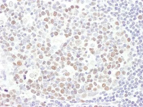 Immunohistochemistry (Formalin/PFA-fixed paraffin-embedded sections) - Anti-KMT6 / EZH2 antibody (AB186006)